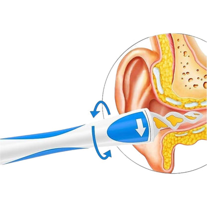Easy Ear Wax Remover.